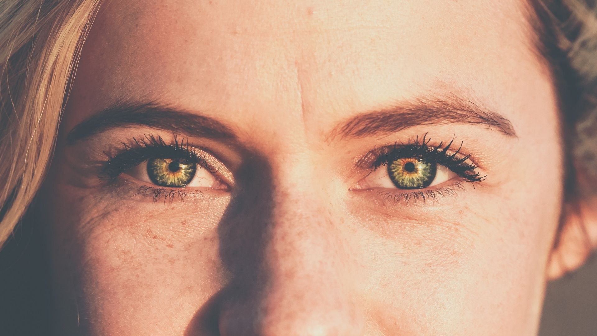 Alsó szemhéjplasztika és szájfeltöltés